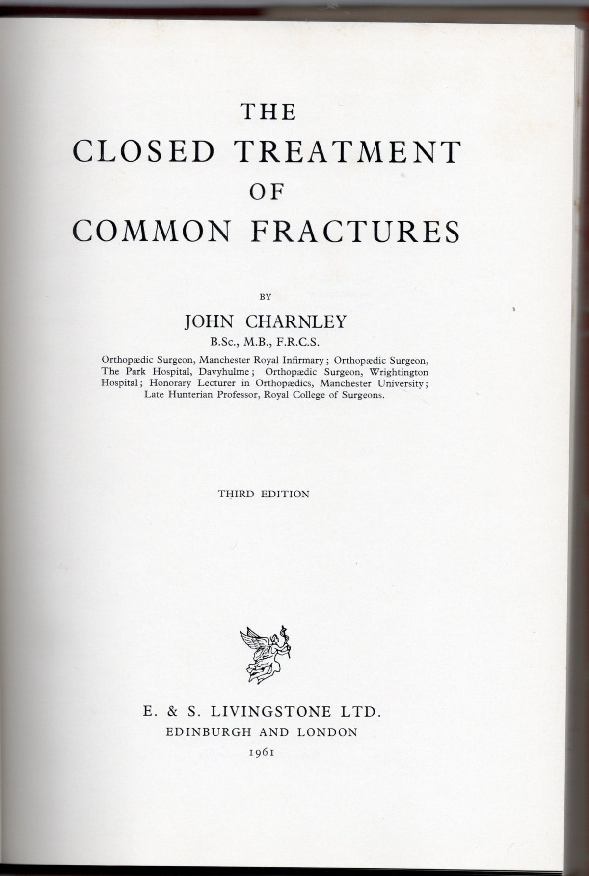 The Closed Treatment of Common Fractures